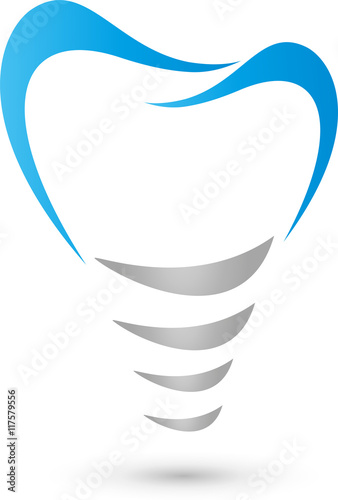 Zahnimplantat, Zahn, Zahnarzt, Logo, Implantat