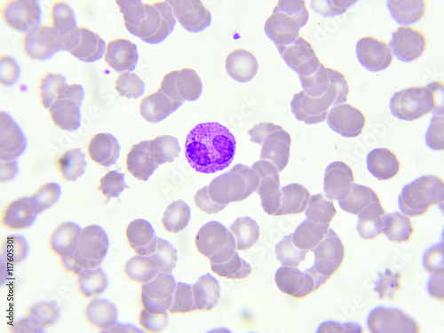 White blood cell in blood smear 