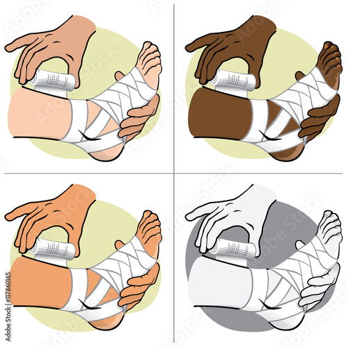 Illustration First Aid person ethnic, standing side view, bandaging the foot. Ideal for catalogs, information and medical guides