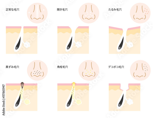 毛穴