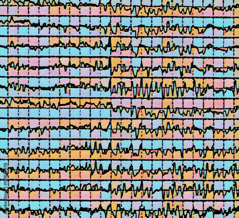 Fototapeta premium brain wave on electroencephalogram EEG for epilepsy, illustration