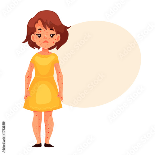 Little girl having chickenpox, cartoon style vector illustration isolated on white background. Cute brown haired girl in yellow dress with smallpox pimples, catching childhood desease