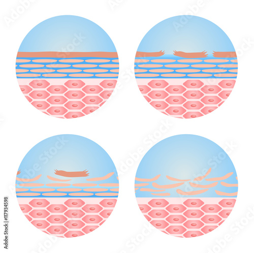 dry skin icon vector . step of dry skin happened .