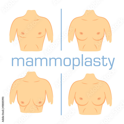 Correction form size breast white back