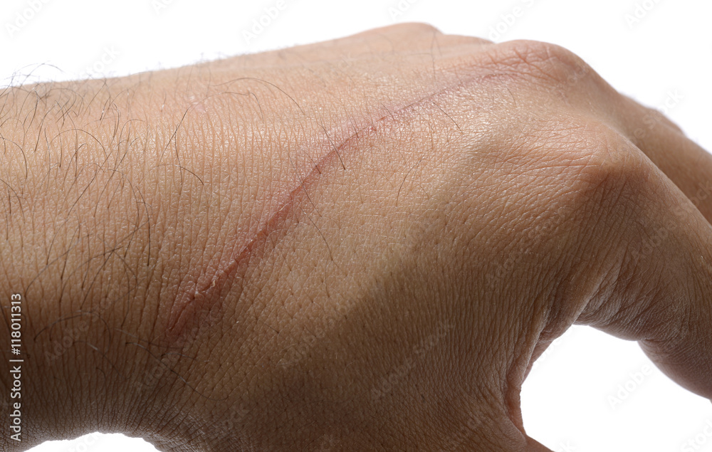 Fototapeta premium Close-up of a cat scratch on a male hand isolated on white background. 