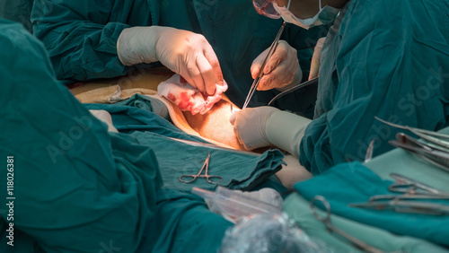 openheart surgery for coronary surgery photo