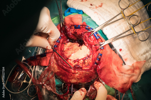 Neurology  surgical
