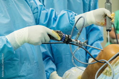 arthroscope surgery photo