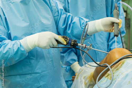 arthroscope surgery