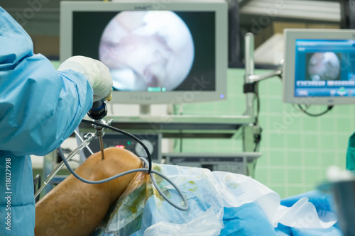 arthroscope surgery