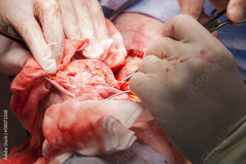 close-up operation to remove the tumor
