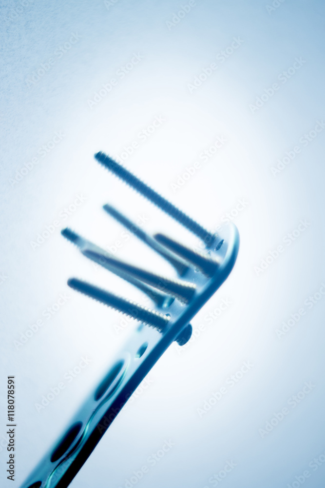 Orthopedic surgery plate & screw implant Orthopedic surgery plate & screw implant