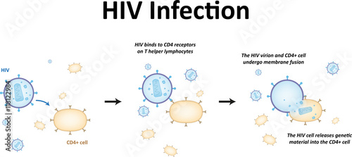 HIV Infection
