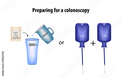 Preparing for a colonoscopy. Purgation. Enema. Vector illustration on isolated background photo