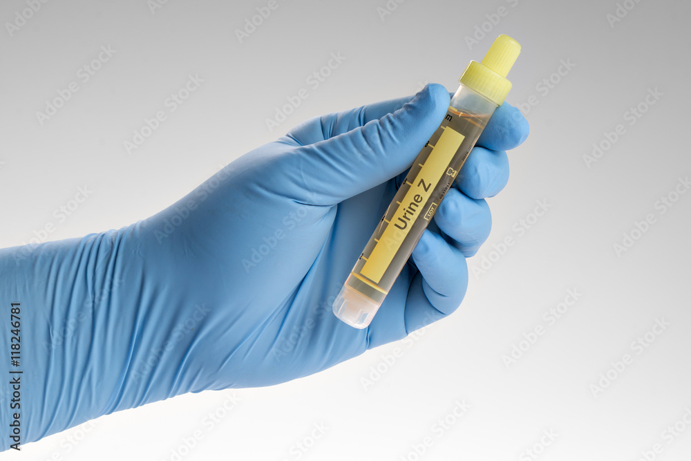 Arzt hält Urin Probe in der Hand (großes Blutbild) Stock Photo | Adobe Stock