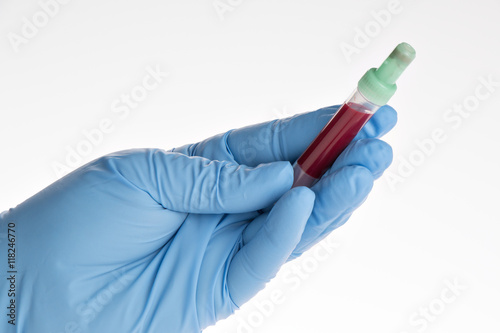 Arzt hält Blutprobe in der Hand (großes Blutbild)