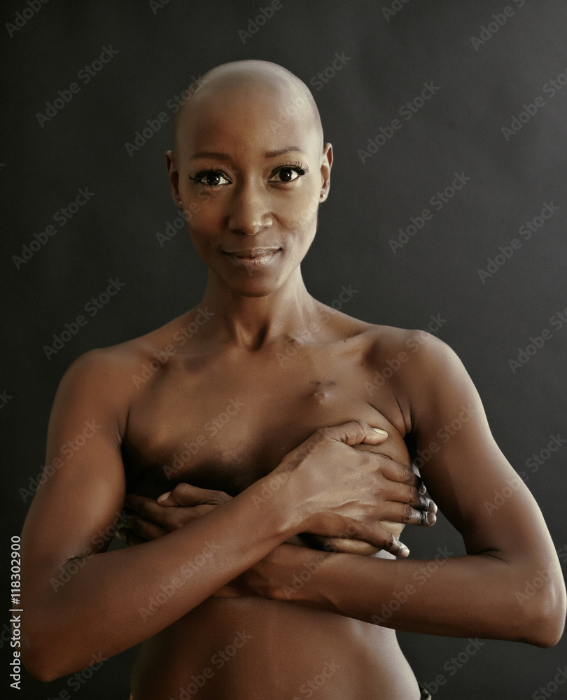 Nude African American cancer survivor covering her breasts Stock Photo |  Adobe Stock