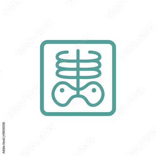 X-ray of rib