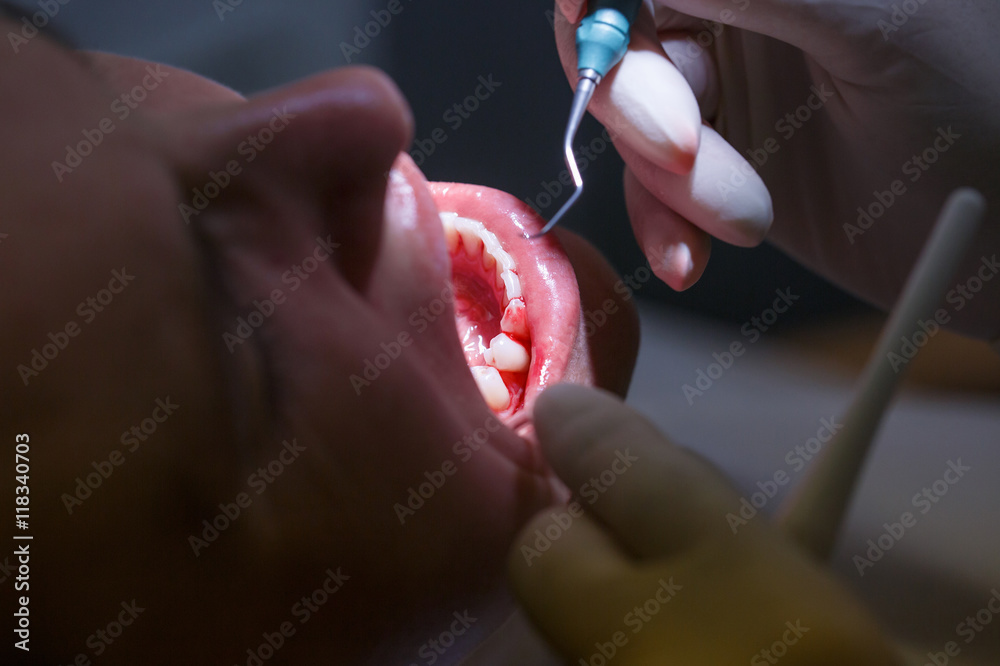 Patient at dental hygienists office