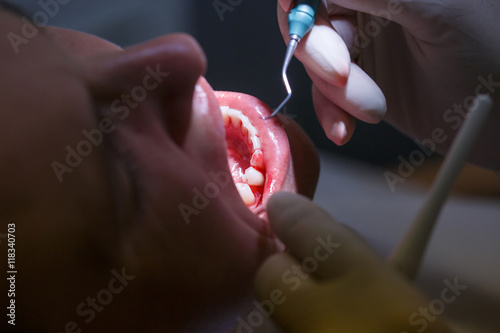 Obraz na płótnie Patient at dental hygienists office w salonie