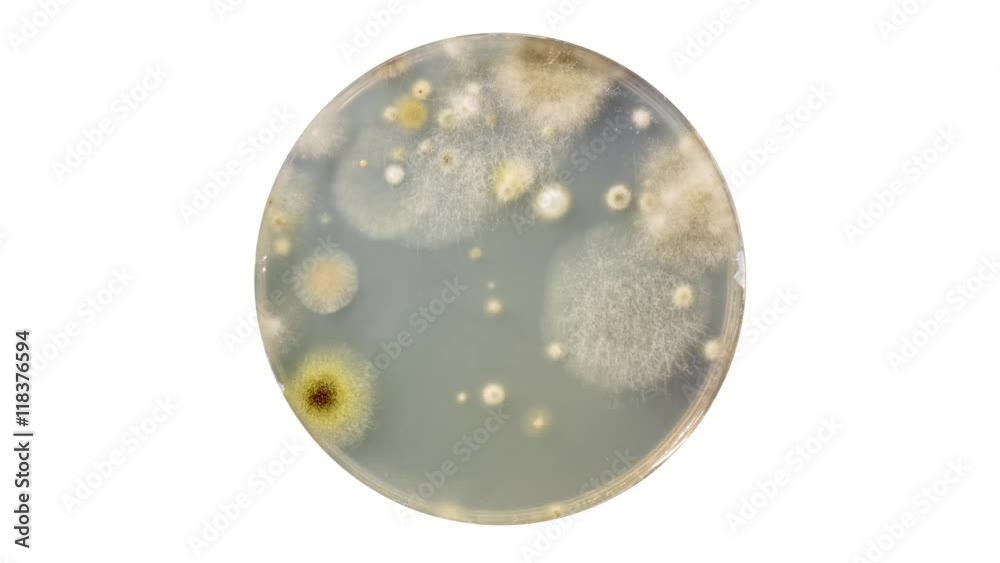 Growing Bacterial Colonies In Petri Dish, Time Lapse Growing Bacterial Colonies In Petri Dish, Time Lapse