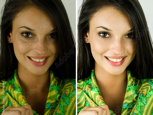 Portrait of a beautiful brunette girl before and after retouching with photoshop. Bad photo vs good photo, acne beauty treatment. Edited photos being compared.