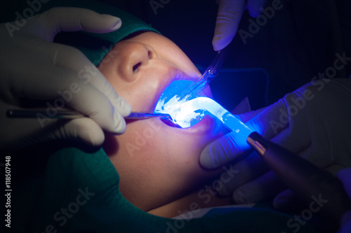 Still Life-Dentist holding mirror dental treatment, dental sealants.