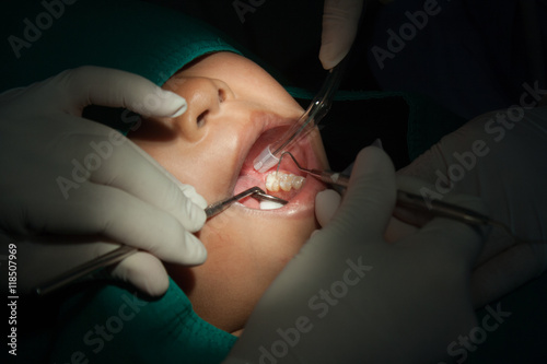 Dentists use dental oral treatment of patients.