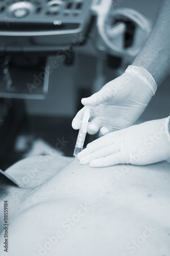  Intratissue Percutaneous Electrolysis EPI