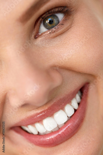 Beautiful Smile. Smiling Woman Face With White Teeth, Full Lips. High Resolution Image