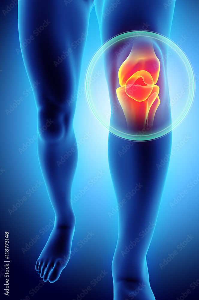 Knee painful - skeleton x-ray. Knee painful - skeleton x-ray.