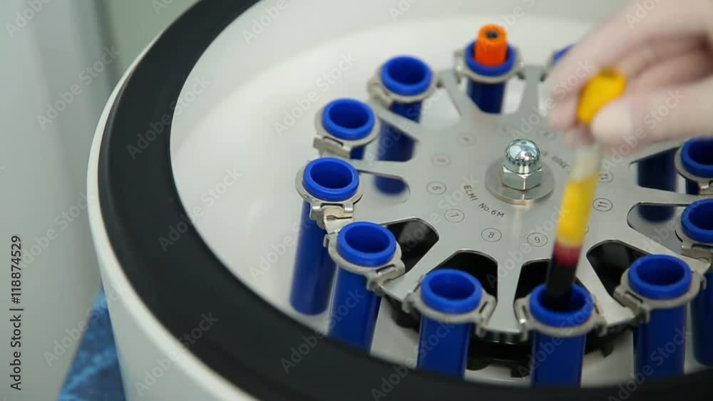 Platelet-Rich plasma preparation. Medical tube with blood plasma for PRP in centrifuge in medical clinic. Plasmolifting.