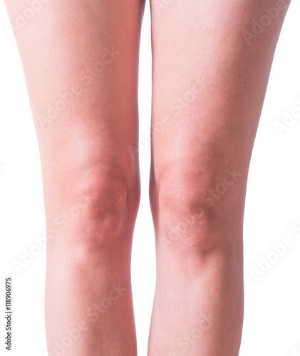 Woman knees isolated on white