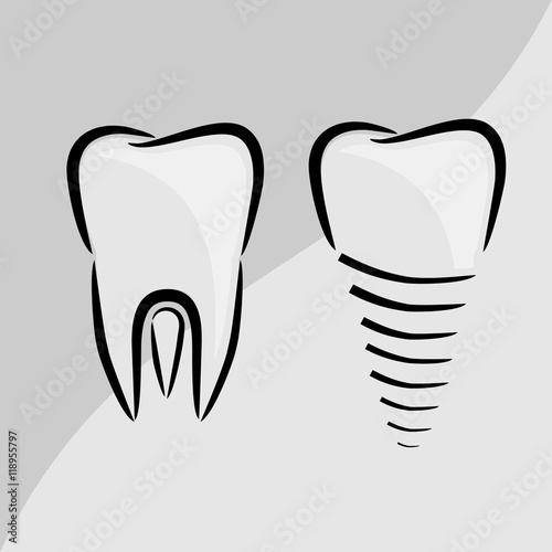 White tooth and Dental implant on the grey background