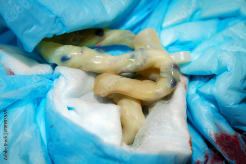 Umbilical Cord After Cut