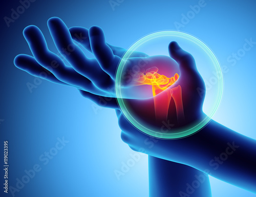 Fototapeta Naklejka Na Ścianę i Meble -  Wrist painful - skeleton x-ray.