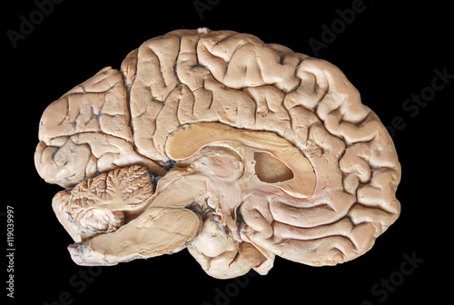 Real human half brain anatomy isolated on black background