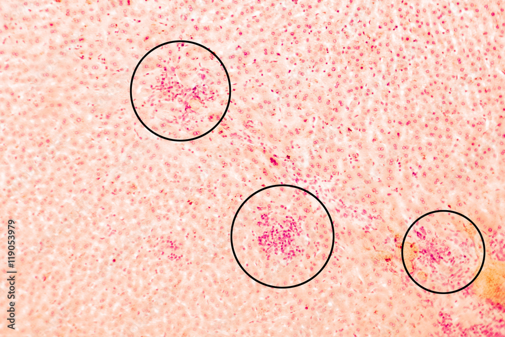 Coccidiosis, coccidia in liver (marked with circles), illustration