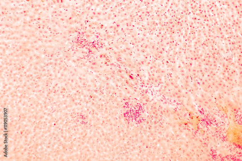 Coccidiosis, coccidia in liver, light micrograph, magnification X50, unlabeled. Micrograph shows bile duct hyperplasia and fibrosis with periductal inflammation, groups of coccidia (in the center)