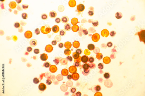 Fotografía Eggs of tapeworm Taenia (pork tapeworm), a helminth transmitted to humans by raw or undercooked meat