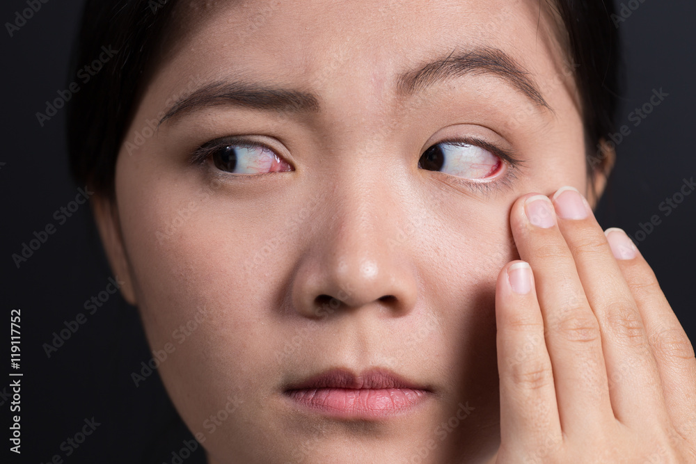 Woman has a pain in eye