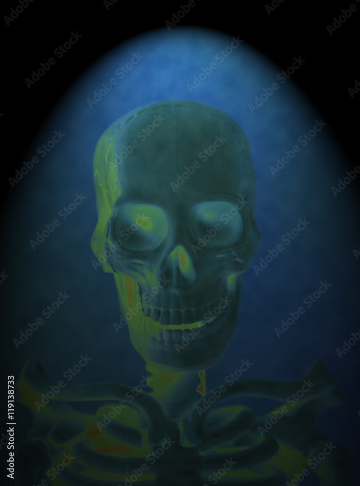 X-ray of a human skull X-ray of a human skull