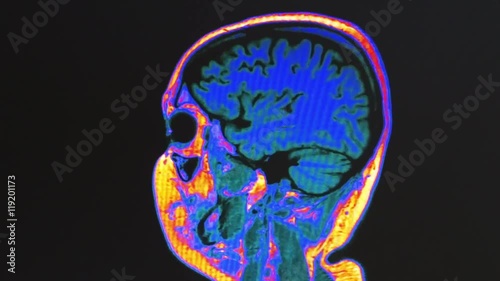 Human brain MRI scan