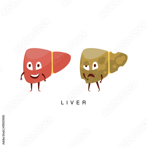 Healthy vs Unhealthy Liver Infographic Illustration