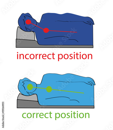 correct and incorrect posture for sleeping on the side. vector illustration