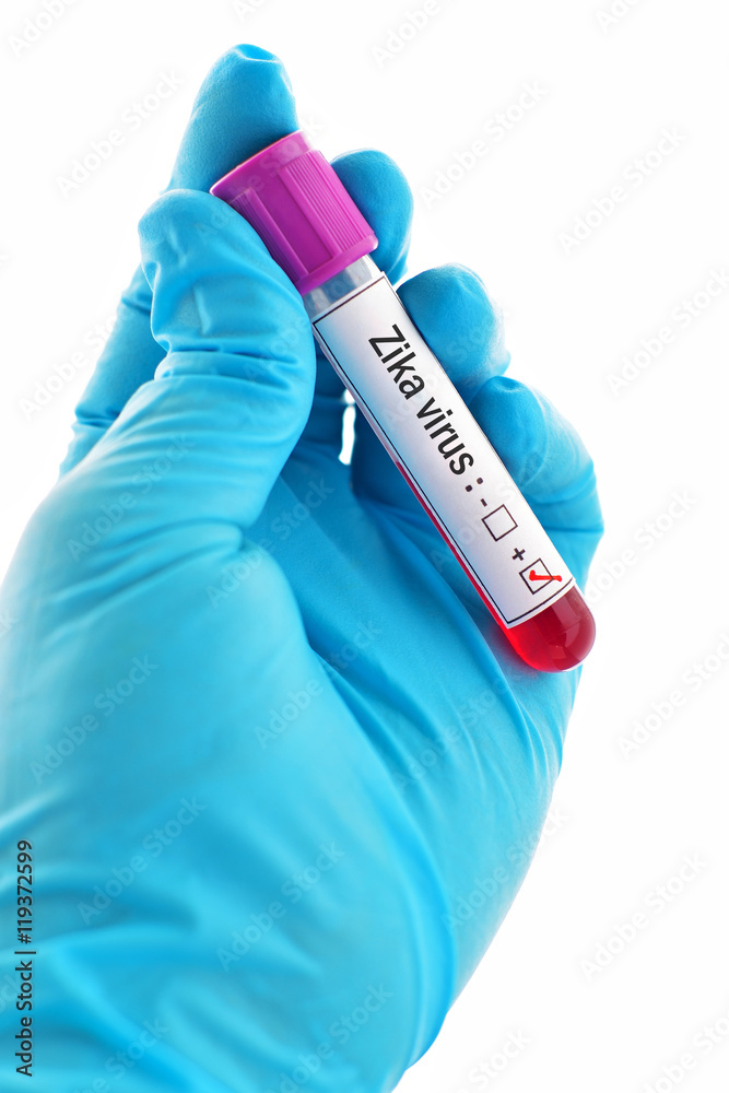 Fototapeta premium Blood sample positive with Zika virus