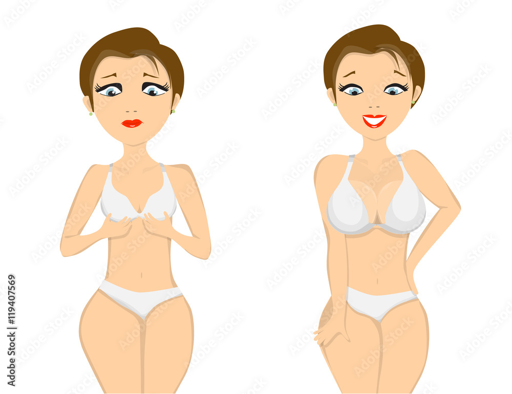 girl before and after breast augmentation on white background girl before and after breast augmentation on white background