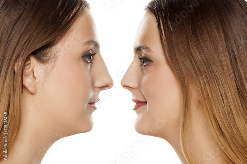 portrait of a young woman, before and after rhinoplasty