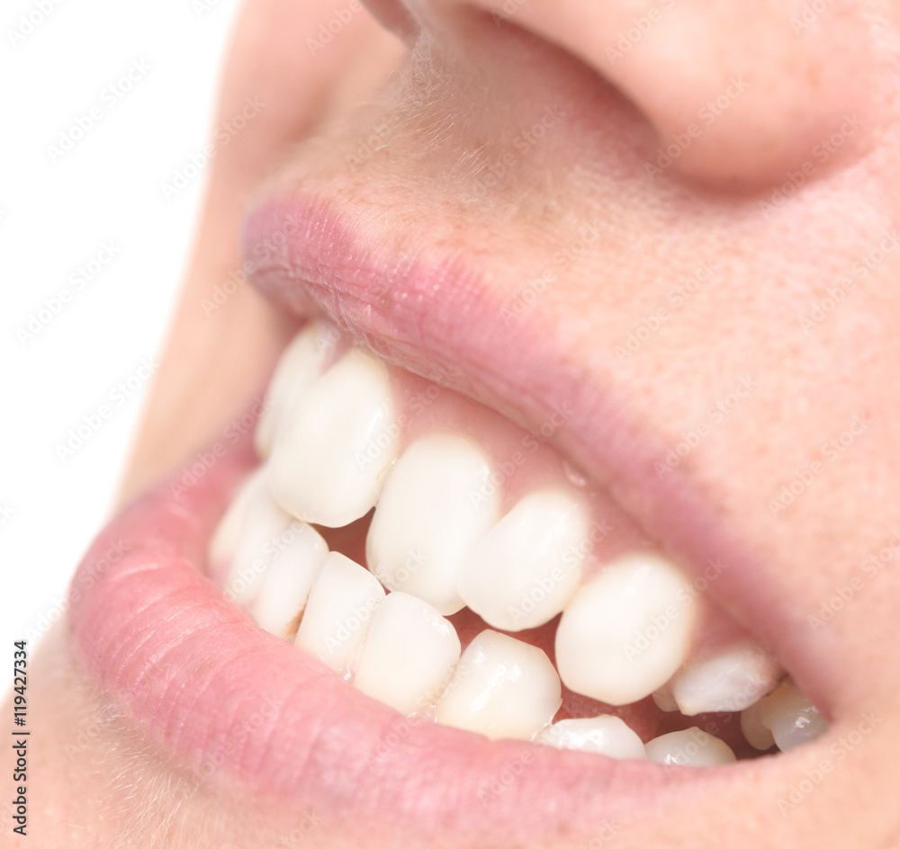 Fototapeta premium woman crooked teeth