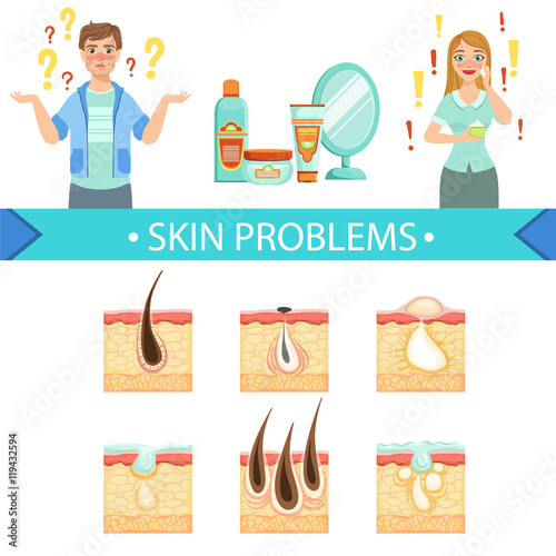 Skin Problems Infographic Medical Poster